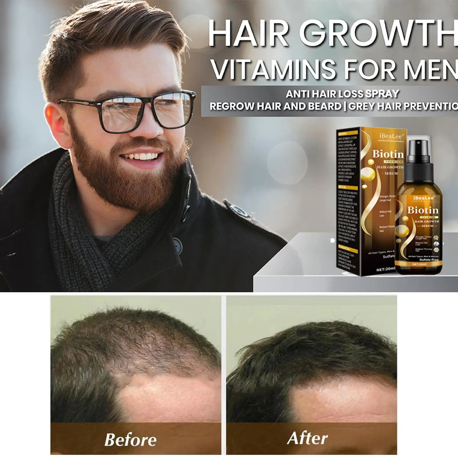 Hair Thickening Care Products Scalp Repair Hair Thicken Conditioner Beard Thickening Care Oil Serum Professional Hair Care