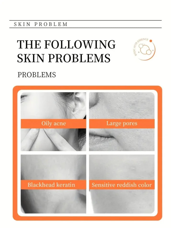 100g Kojic Acid Soap with Vitamin C,Turmeric, Retinol, Shea Butter, Vitamin E, Kojic Acid for Clean and Nourish The Skins