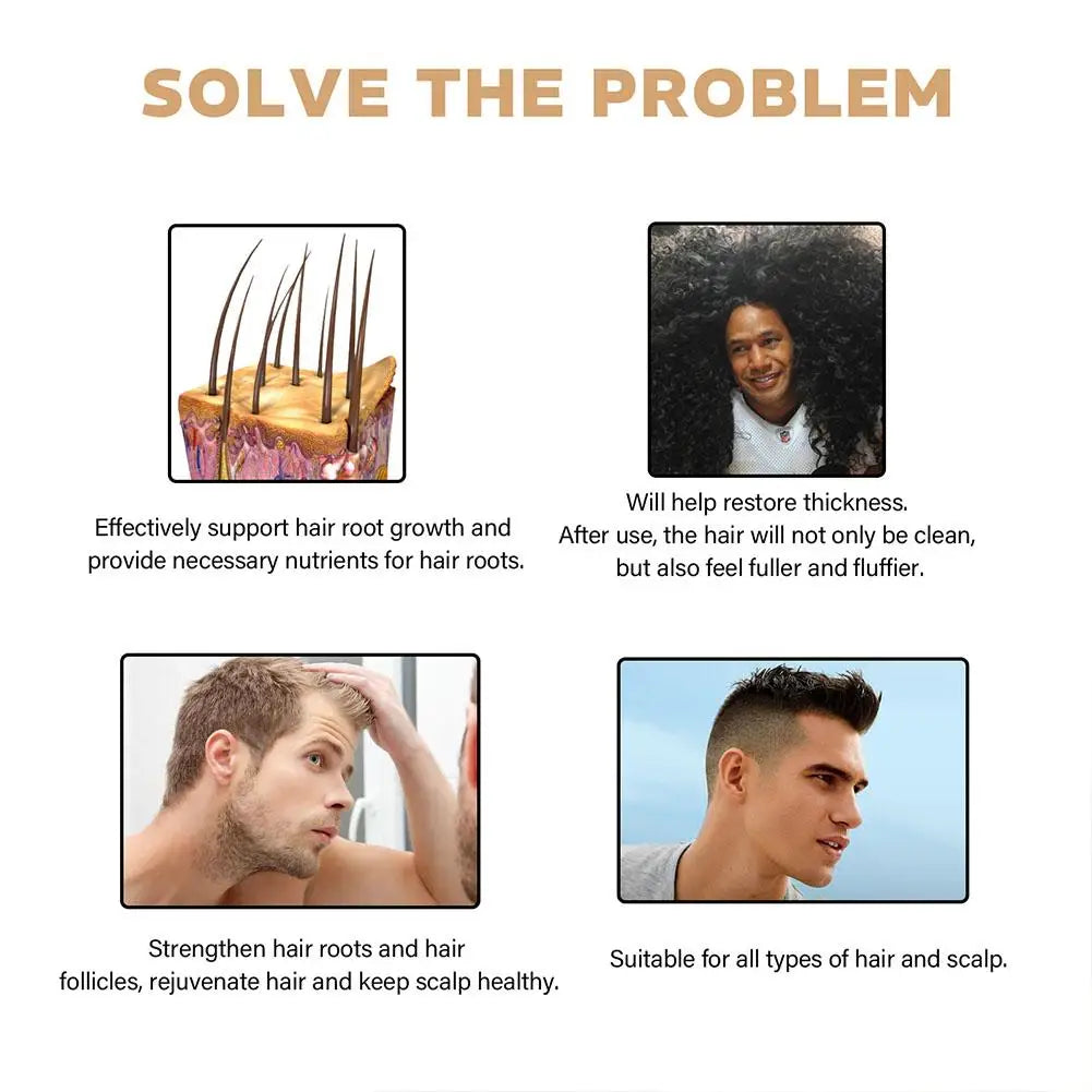 Hair Loss Treatment Shampoo Promotes Growth, Strengthens Roots, Repairs Scalp, Anti-Thinning & Moisturizing Thickening Hair Care