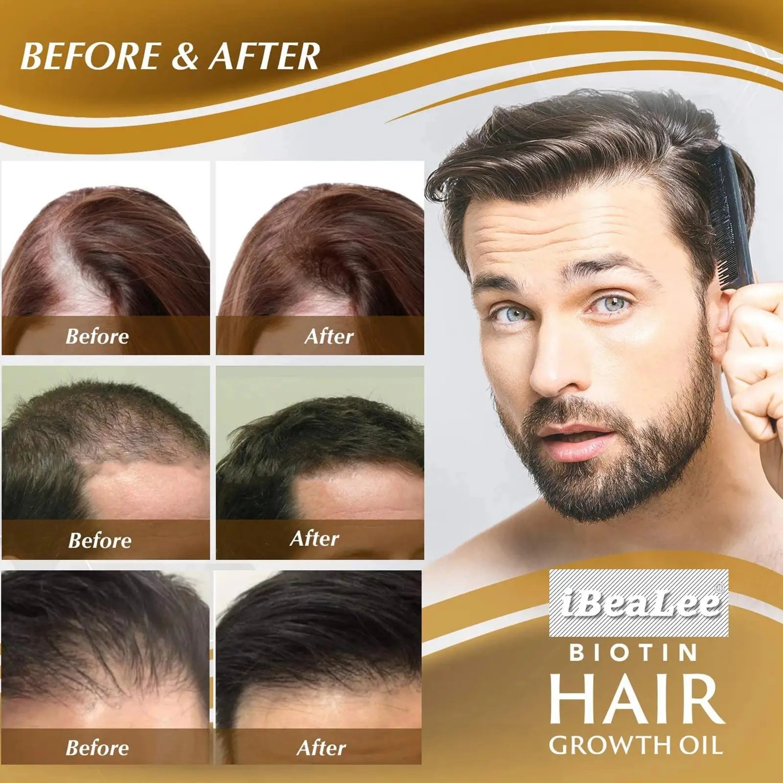 Hair Thickening Care Products Scalp Repair Hair Thicken Conditioner Beard Thickening Care Oil Serum Professional Hair Care