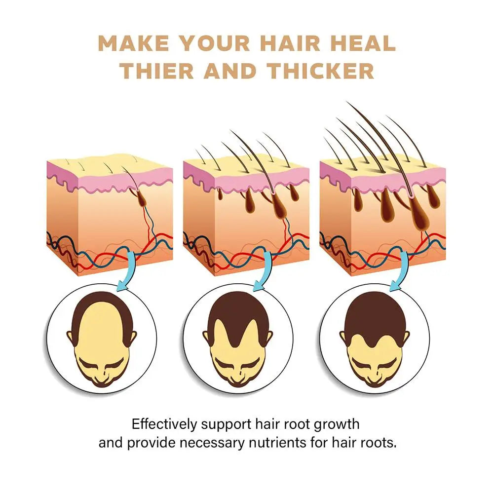 Hair Loss Treatment Shampoo Promotes Growth, Strengthens Roots, Repairs Scalp, Anti-Thinning & Moisturizing Thickening Hair Care